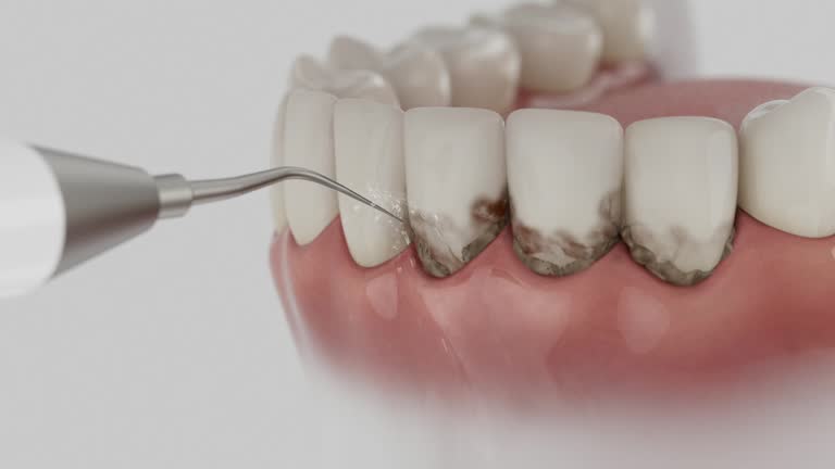 Reliable Dental Implants contractor in Roman Forest, TX by Smile Center Dentistry
